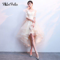 Original Elegant High Low Champagne Bridesmaid Dress 2018 Sexy Lace Backless Tulle Lace Up Formal Wedding Party Dresses